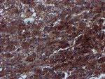 C1S Antibody in Immunohistochemistry (Paraffin) (IHC (P))