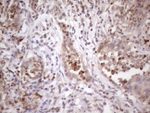 C1orf106 Antibody in Immunohistochemistry (Paraffin) (IHC (P))