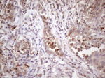 C1orf106 Antibody in Immunohistochemistry (Paraffin) (IHC (P))