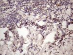 C1orf106 Antibody in Immunohistochemistry (Paraffin) (IHC (P))