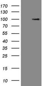 C1orf106 Antibody in Western Blot (WB)