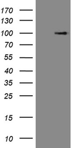 C1orf106 Antibody in Western Blot (WB)