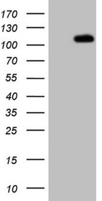 C1orf106 Antibody in Western Blot (WB)