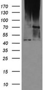 C1orf161 Antibody in Western Blot (WB)