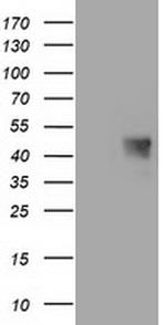 C1orf161 Antibody in Western Blot (WB)