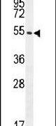 C1orf51 Antibody in Western Blot (WB)