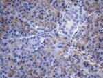 C2 Antibody in Immunohistochemistry (Paraffin) (IHC (P))