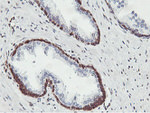 C20orf3 Antibody in Immunohistochemistry (Paraffin) (IHC (P))