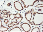 C20orf3 Antibody in Immunohistochemistry (Paraffin) (IHC (P))