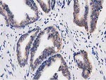 C20orf43 Antibody in Immunohistochemistry (Paraffin) (IHC (P))