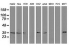 C20orf43 Antibody in Western Blot (WB)