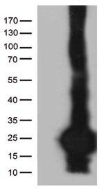C20orf79 Antibody in Western Blot (WB)