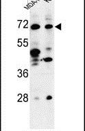 TSPEAR Antibody in Western Blot (WB)