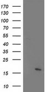 C21orf34 Antibody in Western Blot (WB)