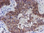 C21orf56 Antibody in Immunohistochemistry (Paraffin) (IHC (P))