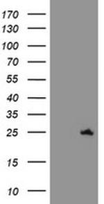 C21orf56 Antibody in Western Blot (WB)