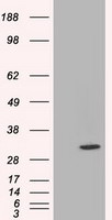C21orf59 Antibody in Western Blot (WB)