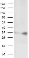 C21orf59 Antibody in Western Blot (WB)