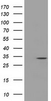 C21orf59 Antibody in Western Blot (WB)