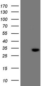 C21orf62 Antibody in Western Blot (WB)