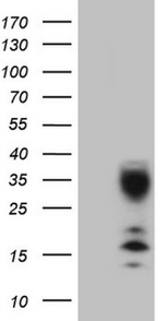 C21orf62 Antibody in Western Blot (WB)