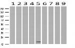 C2orf40 Antibody in Western Blot (WB)