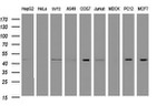 C2orf62 Antibody in Western Blot (WB)