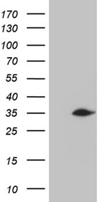 C2orf80 Antibody in Western Blot (WB)