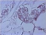 Mouse IgG (H+L) Secondary Antibody in Immunohistochemistry (Paraffin) (IHC (P))