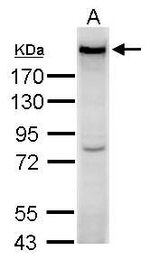 Complement C3 Antibody in Western Blot (WB)
