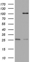 C3orf15 Antibody in Western Blot (WB)