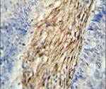 C3orf75 Antibody in Immunohistochemistry (IHC)