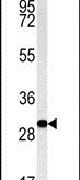 C3orf75 Antibody in Western Blot (WB)