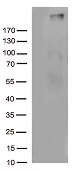 C4B Antibody in Western Blot (WB)