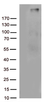 C4B Antibody in Western Blot (WB)