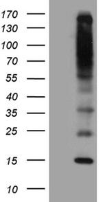 C5orf56 Antibody in Western Blot (WB)