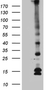 C5orf56 Antibody in Western Blot (WB)