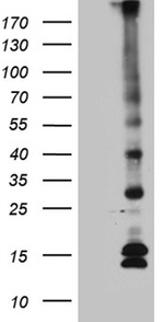 C5orf56 Antibody in Western Blot (WB)