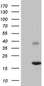 C5orf56 Antibody in Western Blot (WB)