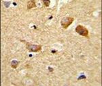 C6orf170 Antibody in Immunohistochemistry (IHC)