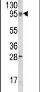 C6orf170 Antibody in Western Blot (WB)