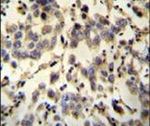 C6orf58 Antibody in Immunohistochemistry (IHC)