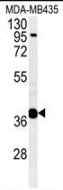 PPP1R35 Antibody in Western Blot (WB)
