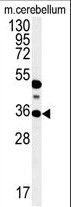 PPP1R35 Antibody in Western Blot (WB)