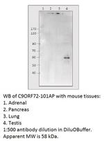 C9orf72 Polyclonal Antibody