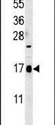 CA095 Antibody in Western Blot (WB)