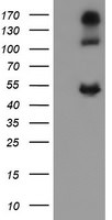 CA12 Antibody in Western Blot (WB)