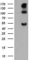 CA12 Antibody in Western Blot (WB)