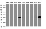 CA12 Antibody in Western Blot (WB)