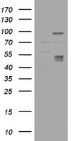 CA12 Antibody in Western Blot (WB)